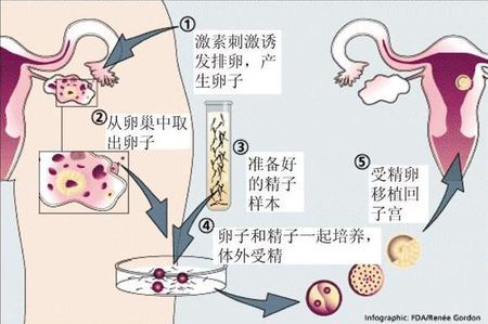 慈安中西医结合试管中心